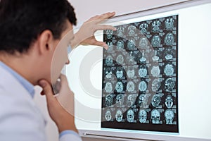 Serious thoughtful radiologist looking for a brain pathology photo