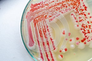 Serratia marcescens is a species of rod-shaped gram-negative bacteria. photo