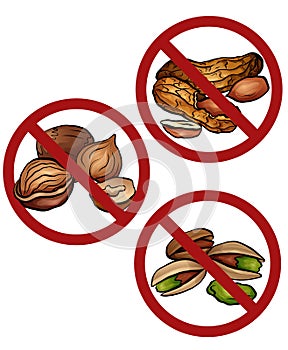 Set of cartoon nuts in the prohibition sign. Free from nuts. Ban on allergens. Allergy Alert. Badges with forbiddance photo