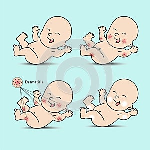 Set dermatitis baby photo