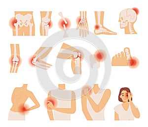 Set of different body pain vector flat illustration. Headache, pain in the arm, leg, shoulder, and lower back.