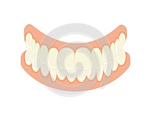 Set of false teeth. Implanted jaw.