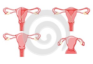 Set of Female reproductive system uterus in different styles and cross sections. Front view in a cut. Human anatomy