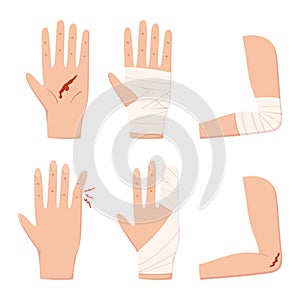 Set of Hand, Palm, Elbow, Finger and Arm Injury with Blood and Bandage Isolated on White Background. First Aid, Health