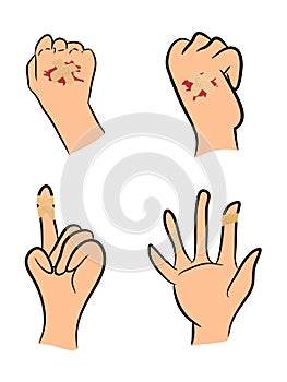 Set of Injured finger and hand with adhesive plaster and red blood puddle. Vector illustration on white background.