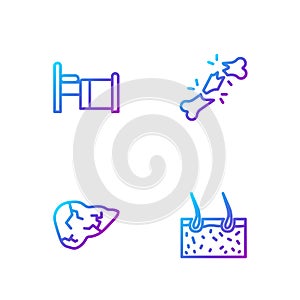 Set line Hair covering skin, Hepatitis virus, Hospital bed and Human broken bone. Gradient color icons. Vector