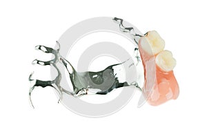 A set of partial dentures with metal plate
