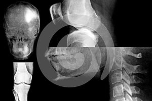 Set of x-ray body parts such as human knee, head, jaw and teeth, group of x-ray images for diagnosing different types of