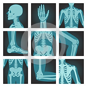 Set of x-ray shots pictures of human body parts, head, wrist, rib cage, foot, spine, knee, cubit, shoulder, vector