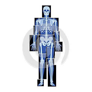 Set of X-Ray Skeleton Human body parts - hands, legs, chest, head, vertebrae, pelvis, Bones adult people roentgen front