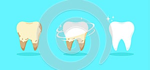 Set of teeth on blue background. Vector illustration of cleaning stage or whitening from unhealthy to healthy teeth, hygiene,