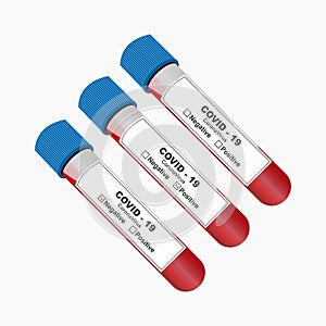 Set of test tube with blood sample for COVID-19 using a blue lid, Coronavirus test. Positive and negative Coronavirus Covid-19 tes
