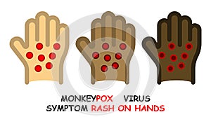 flat linear icons of monkeypox symptom 