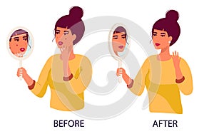 set of women sad Young woman hand mirror worrying about her acne on face in flat design. Pimple problem on female skin