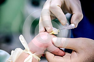 Setting an anesthesiologist of a peripheral catheter to a patient before surgery to monitor the condition.