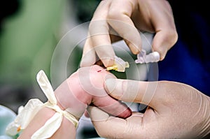 Setting an anesthesiologist of a peripheral catheter to a patient before surgery to monitor the condition. The doctor`s hands prot