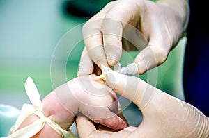 Setting an anesthesiologist of a peripheral catheter to a patient before surgery to monitor the condition during surgery. The doct