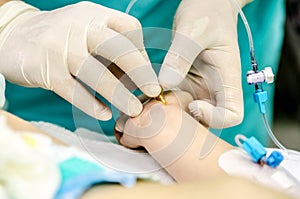 Setting the doctor of a peripheral catheter to monitor invasive blood pressure.