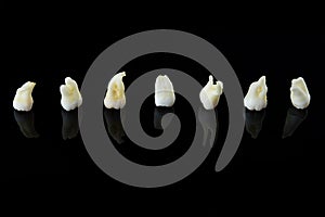 Seven removed diseased human teeth stacked in a row on black background. Close-up photo of spoiled molars and premolars.