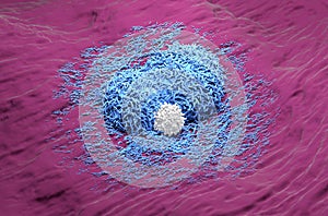 Liver cancer hepatoma with t-cell blue color 3d rendered illustration photo