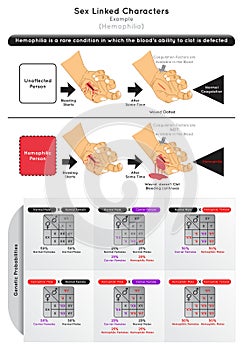 Sex Linked Characters Infographic Diagram example hemophilia bleeding