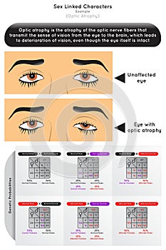 Sex Linked Characters Infographic Diagram with example of optic atrophy