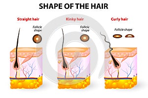 Shape of the hair and hair anatomy