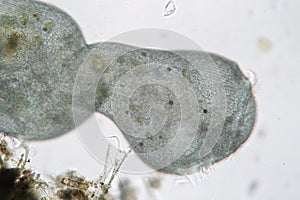 Shape transformation of Stentor or trumpet animalcules. Filter-feeding microorganism, heterotrophic protozoan ciliate photo