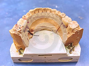 Sharpened  and polished tooth model on dental construction