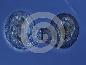 Shell amoeba with sparkle feet
