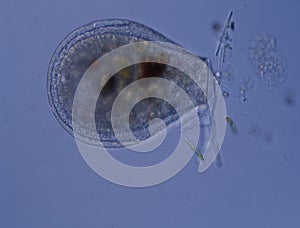 Shell amoeba with sparkle feet photo