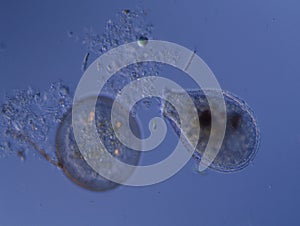 Shell amoeba with sparkle feet