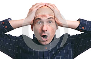 Shocked bald guy. hair loss. Isolated