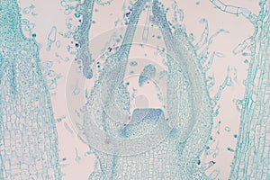 Shoot meristem is the tissue in most plants containing undifferentiated cells