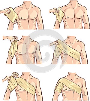 Shoulder bandage illustration