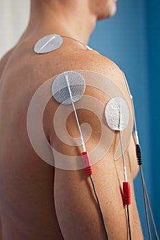 Shoulder Electrical Stimulation / TENS photo