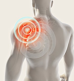 Shoulder painful skeleton x-ray, 3D illustration.