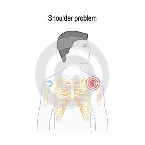 Shoulder problem