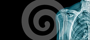 Shoulder banner x-ray image