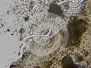 Shower curtain skum in microscope