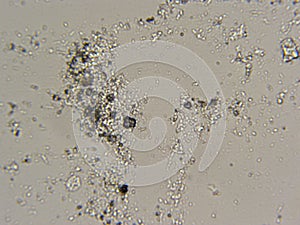 Shower curtain skum in microscope