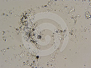 Shower curtain skum in microscope photo