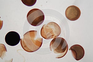 Shrimp eggs under the microscope