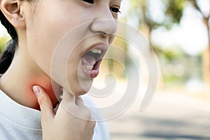 Sick asian child girl has sore throat,cough,hoarseness,laryngeal cancer,hand touch her neck,woman with throat problem,tonsillitis