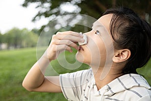 Sick asian child girl using tissue paper for stop bleeding from the nose,female teenage with nosebleed or epistaxis suffer from