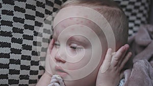 sick baby toddler child suffering from chickenpox symptoms lying sofa fever