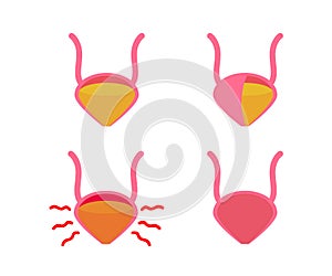 Sick bladder on a white background. Cystitis. Symbol. Vector