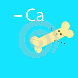 Sick bone without calcium vector