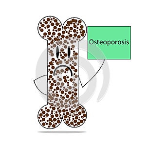 Sick bone with osteoporosis.