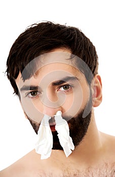 Sick man with tissues in nose.